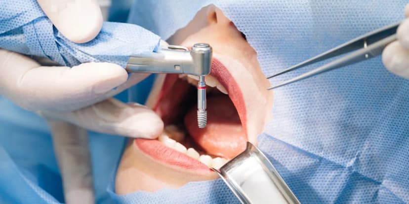Tratamientos Dentales Avanzados